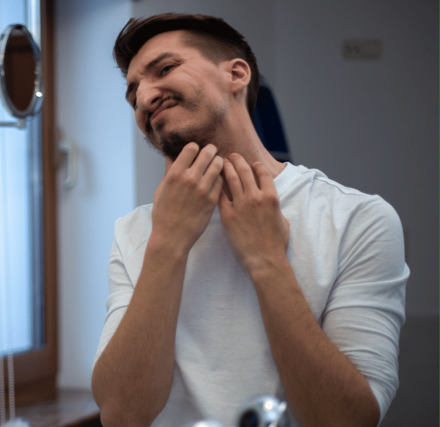 Barba falhada Raspar ou assumir Tribo da conquista Capa Web Stories